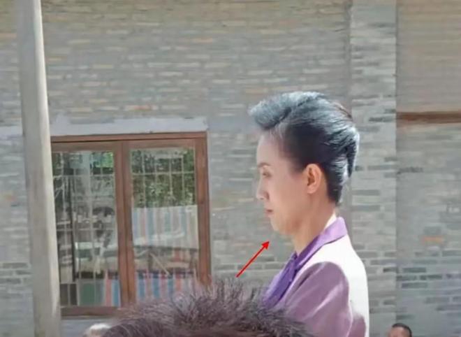 朱媛媛去世前照片曝光！瘦成纸片人大热天用厚毛衣裹着肚子(图4)